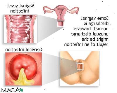 Hvordan skal man behandle med menstruation lugt. Brug sundere menstruation produkter.
